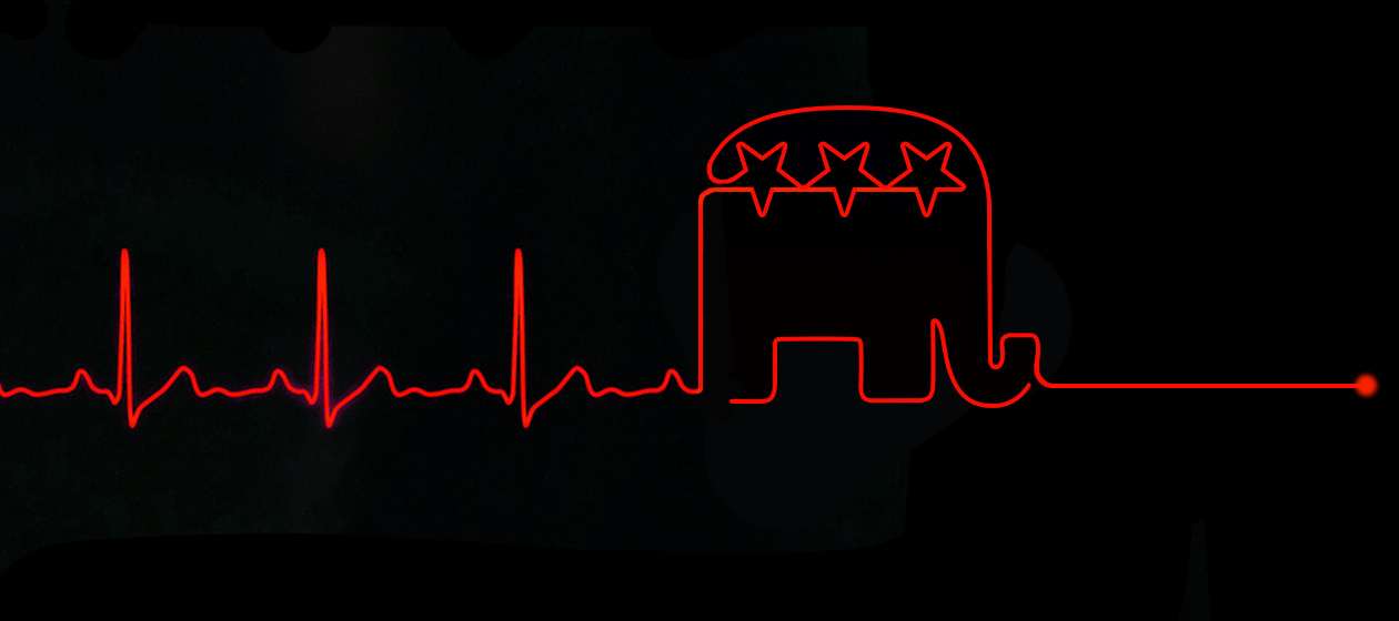 A heart monitor.